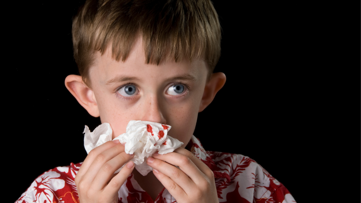 Um menino com o nariz sangrando. 