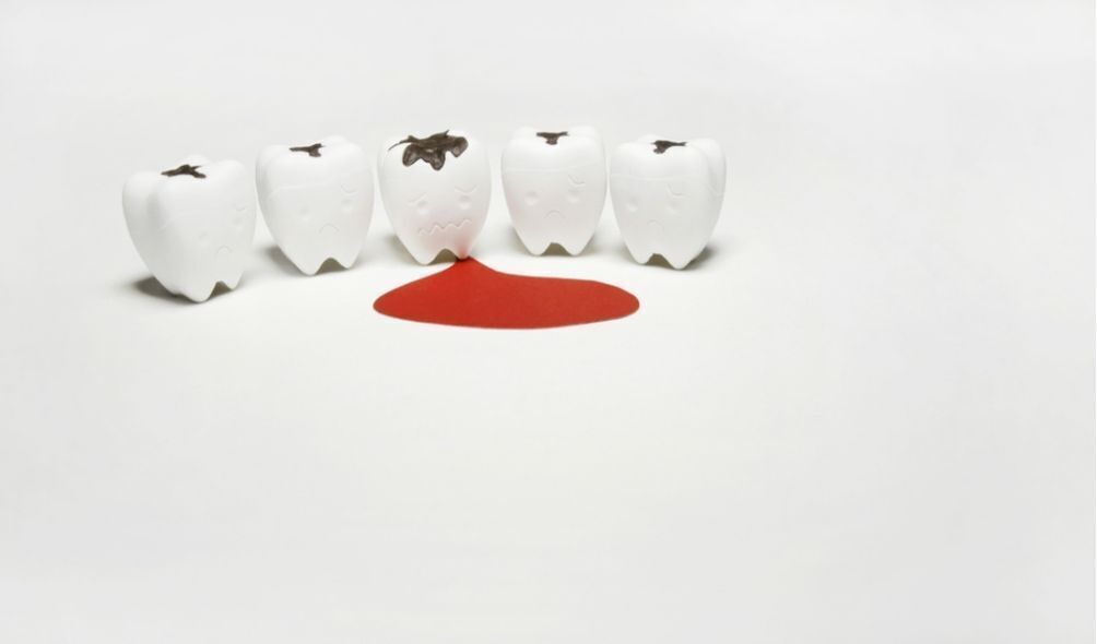 Dentes em miniatura caricata com sangue ao lado