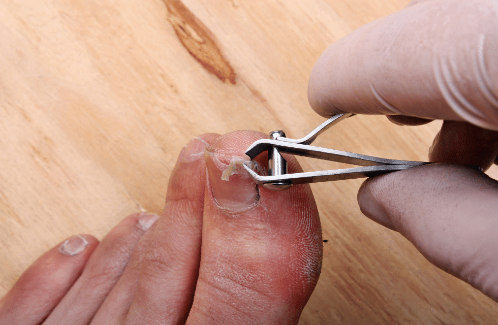 Pessoa cortando a unha do dedão do pé