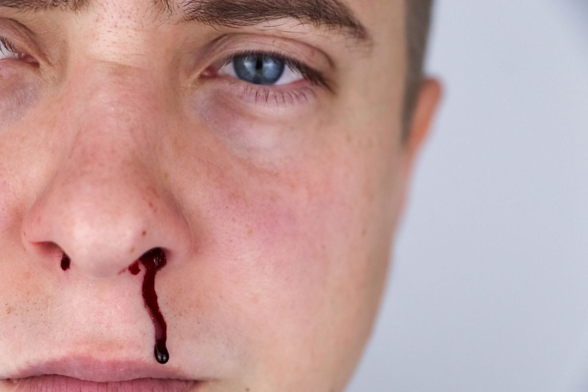 Homem sangrando pelo nariz.