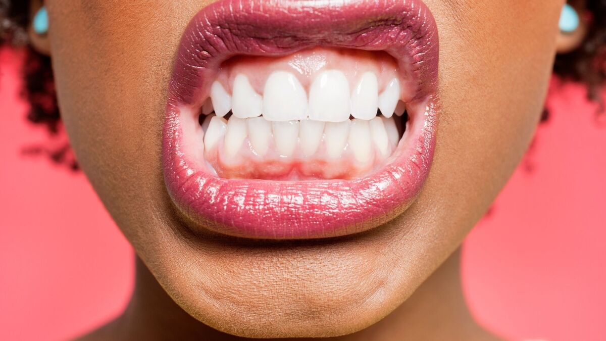 Dentes em uma boca de mulher.