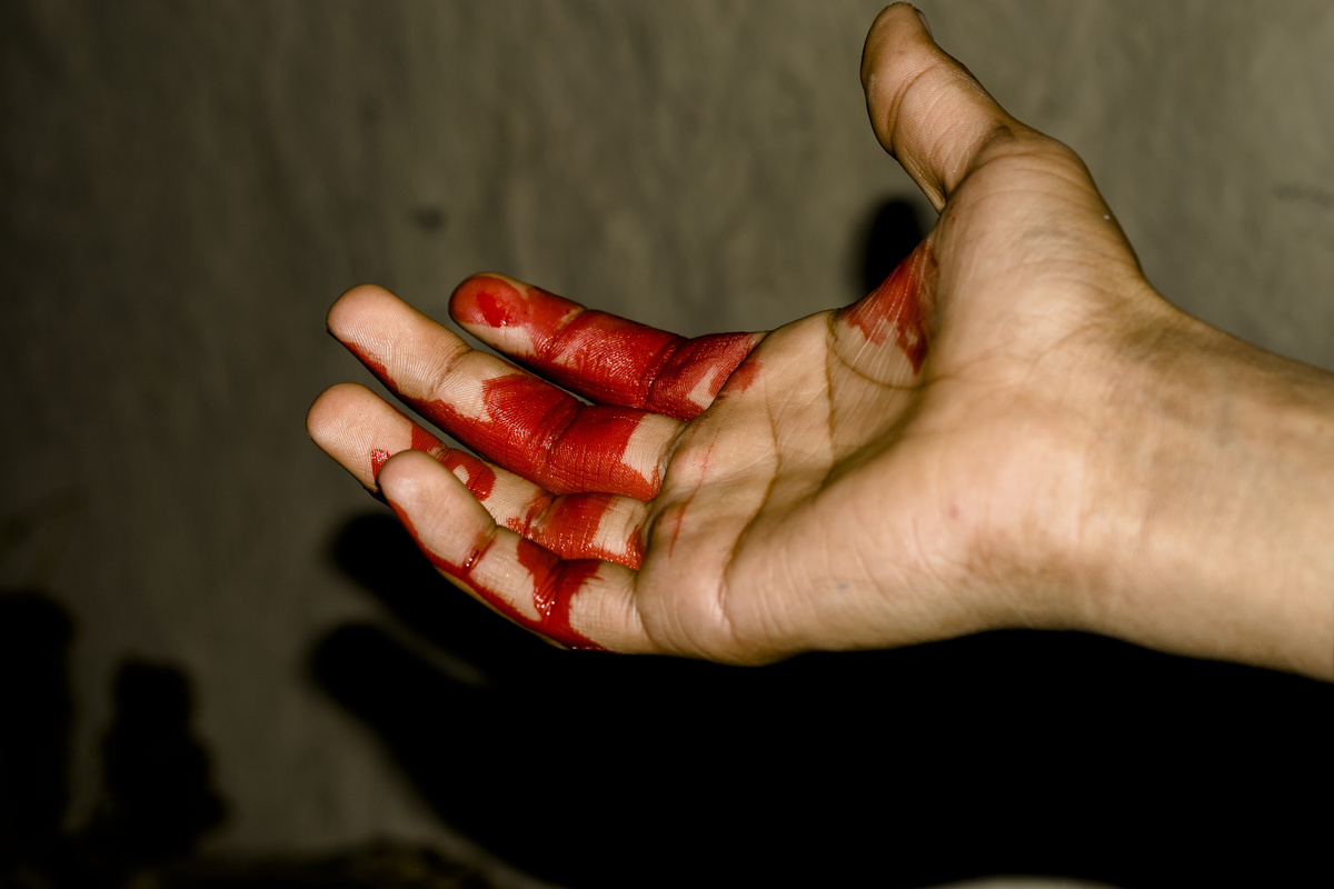 Mão com sangue