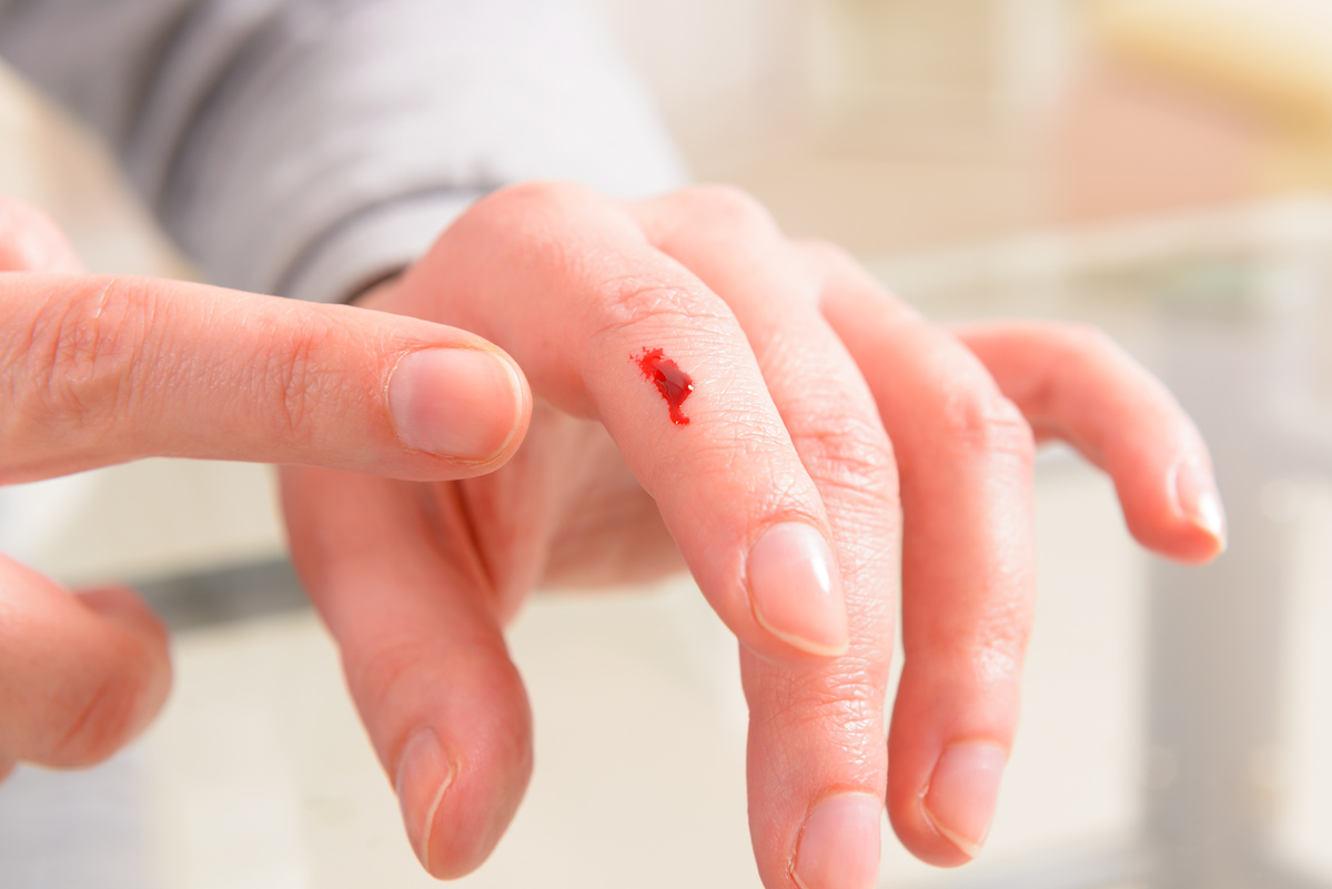 Dedo indicador cortado sangrando
